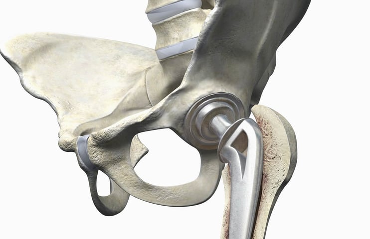 Biomaterial & Medical Devices Surface Treatments & Coatings Biolin